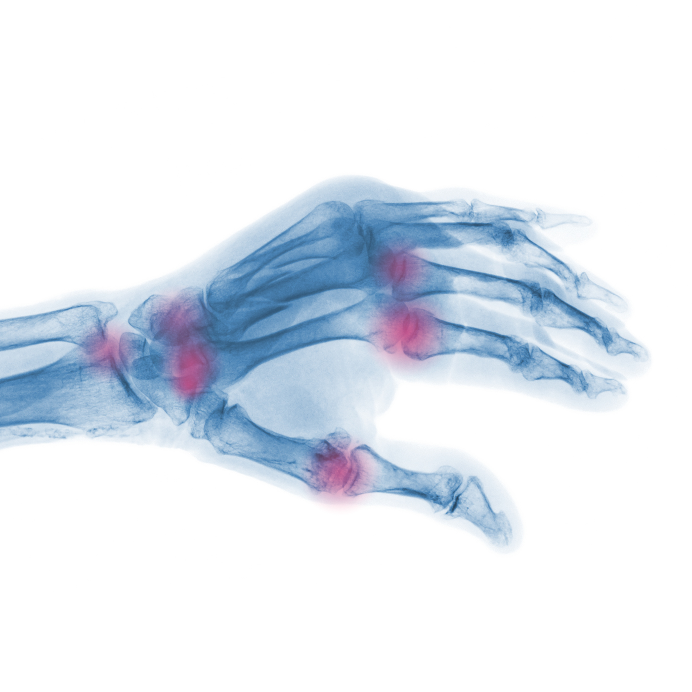 SetPoint_inflammatory_reflex_applications_xray