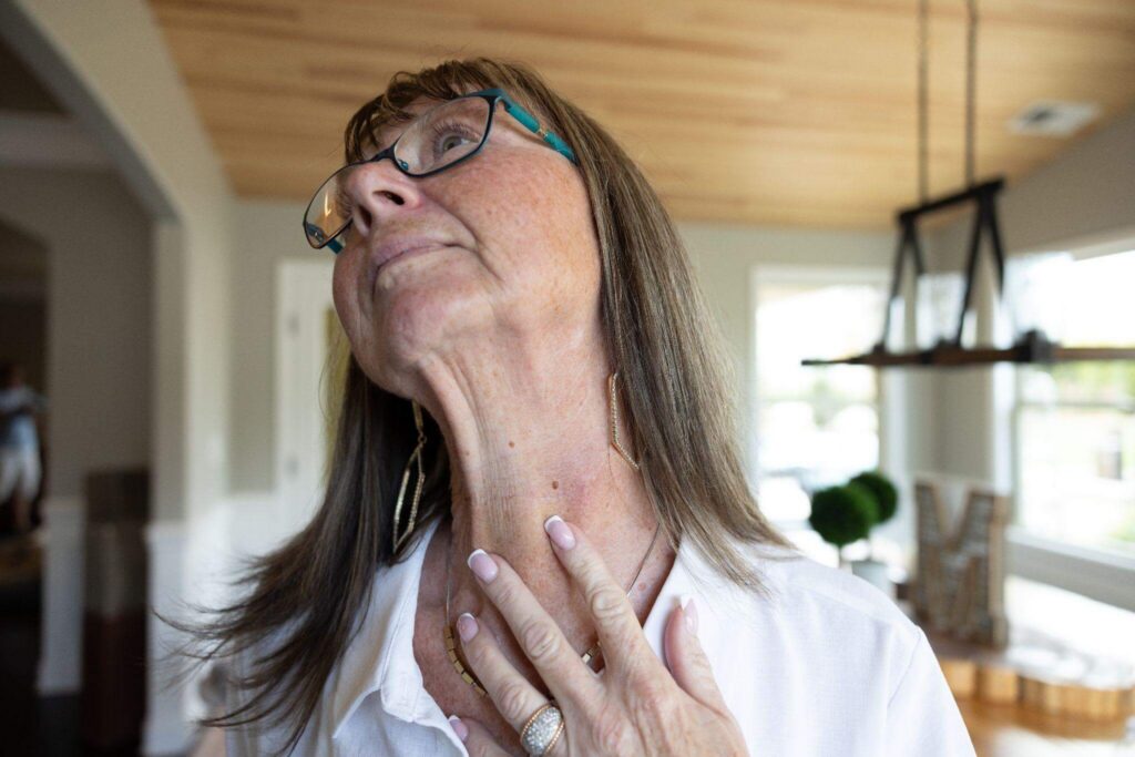  Lynn, pointing to her surgical scar from the SetPoint implant procedure.